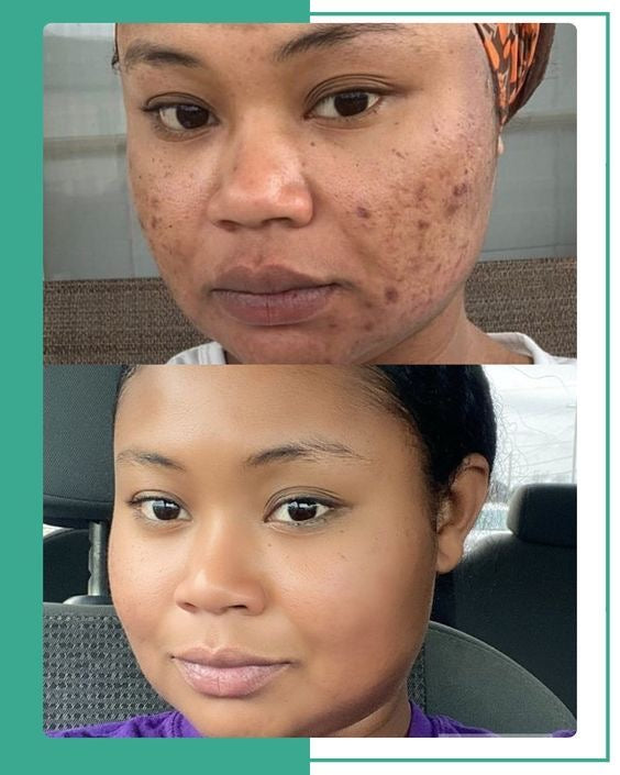 Golden Face Lightening Oil